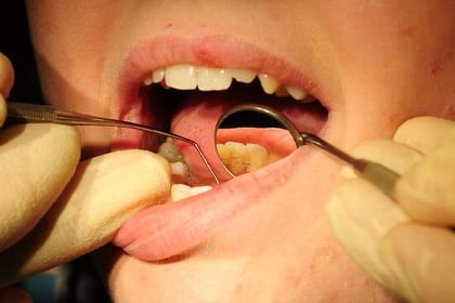 Just a third of Cornwall adults see their dentist during pandemic